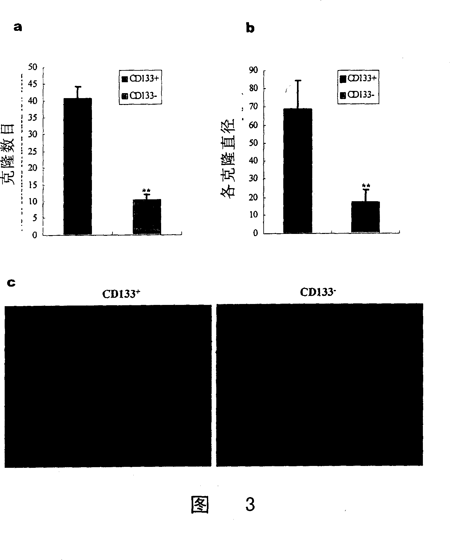 Liver-cancer stem cell, its separation and use