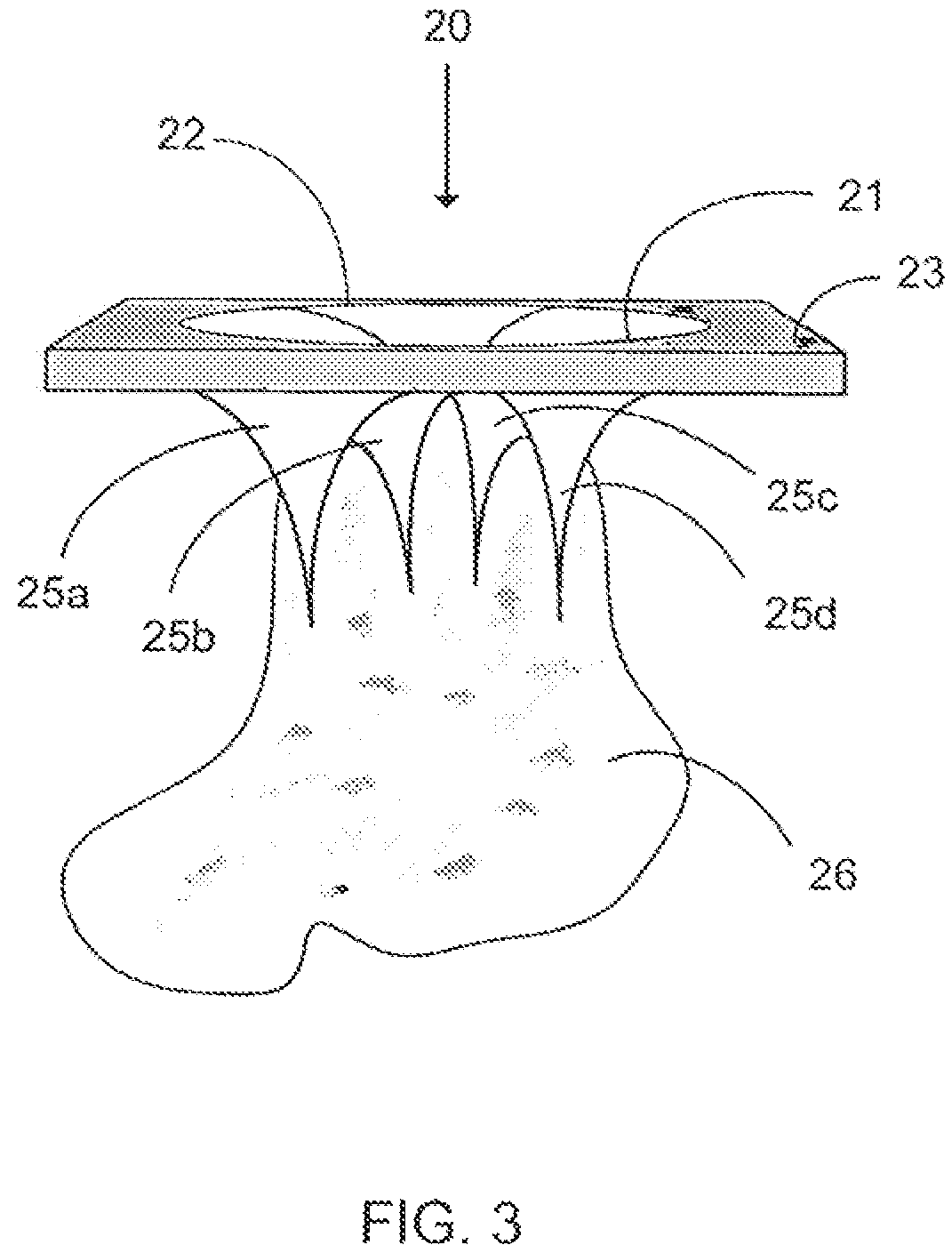 Pouch with flexible self-sealing dispensing valve