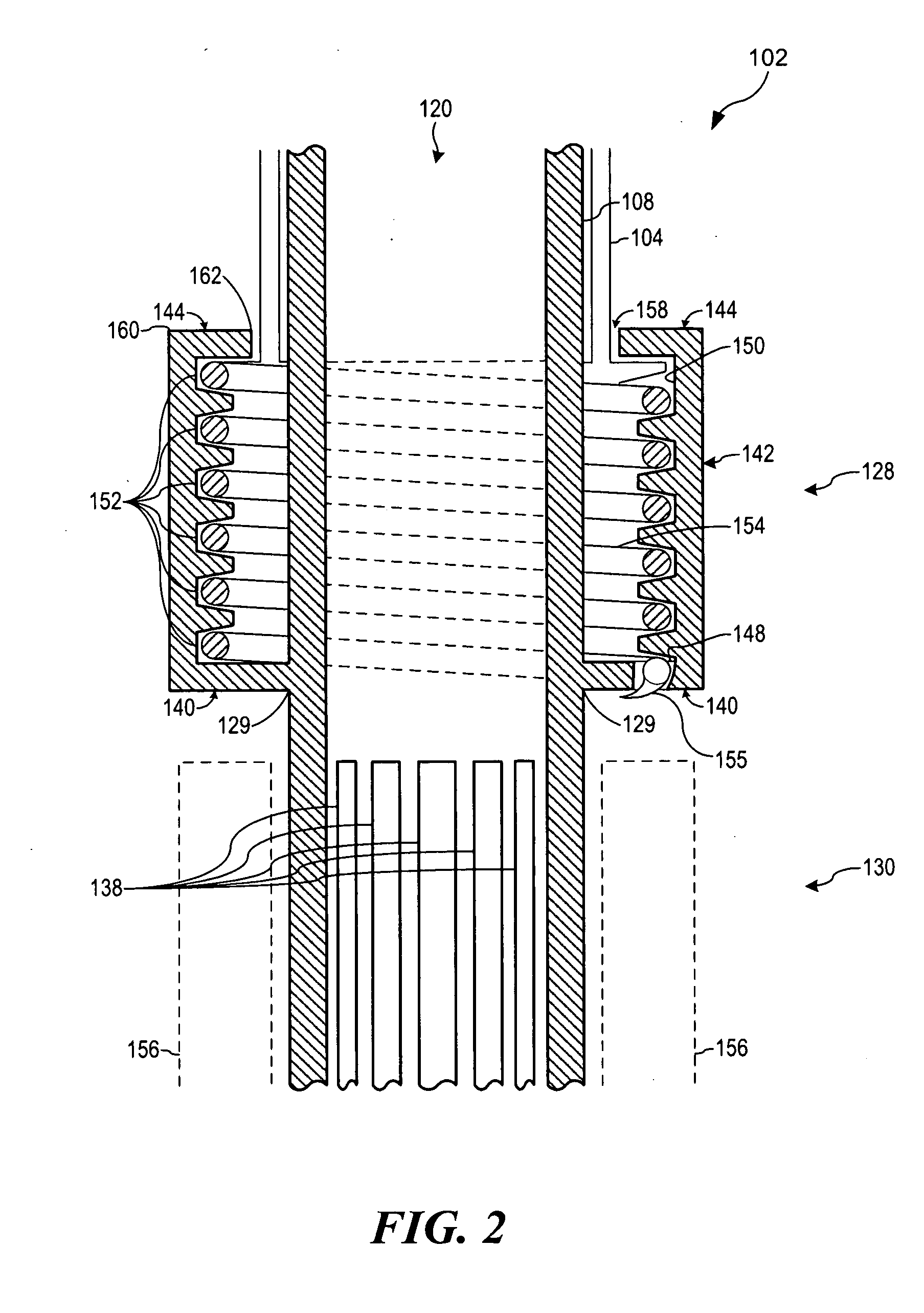Apparatus and method for gastric reduction