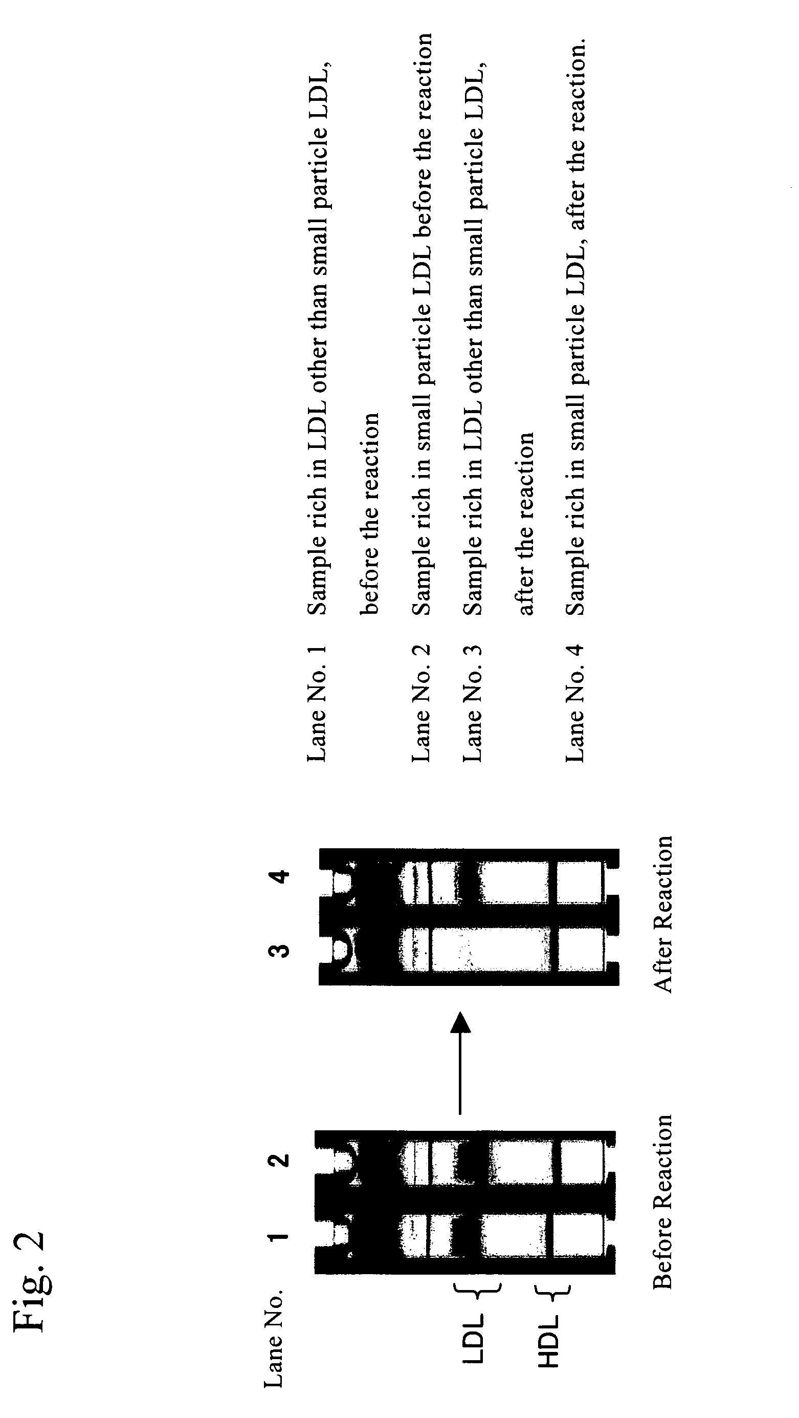 Method of quantifying small-sized low density lipoprotein