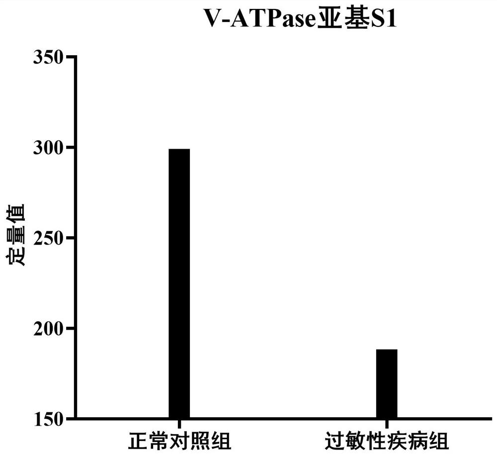 Urine V-ATPASE subunit S1 and application of polypeptide fragment of urine V-ATPASE subunit S1 in allergic diseases