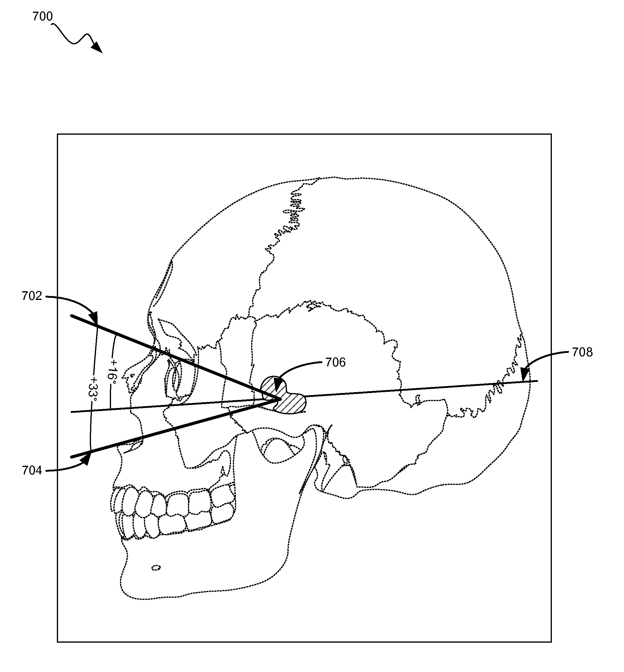 Methods And Systems For Selecting Surgical Approaches