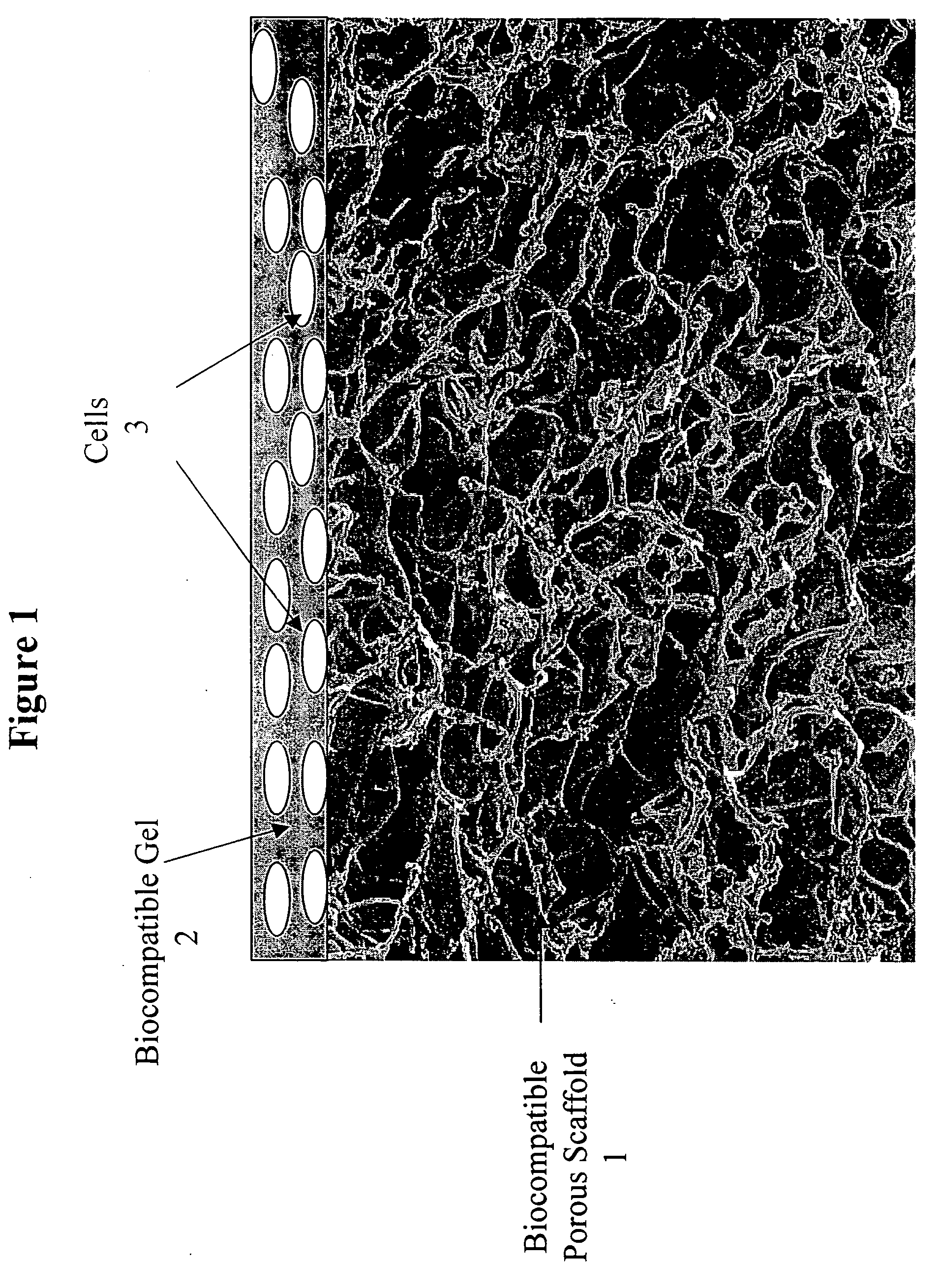 Tissue composites and uses thereof