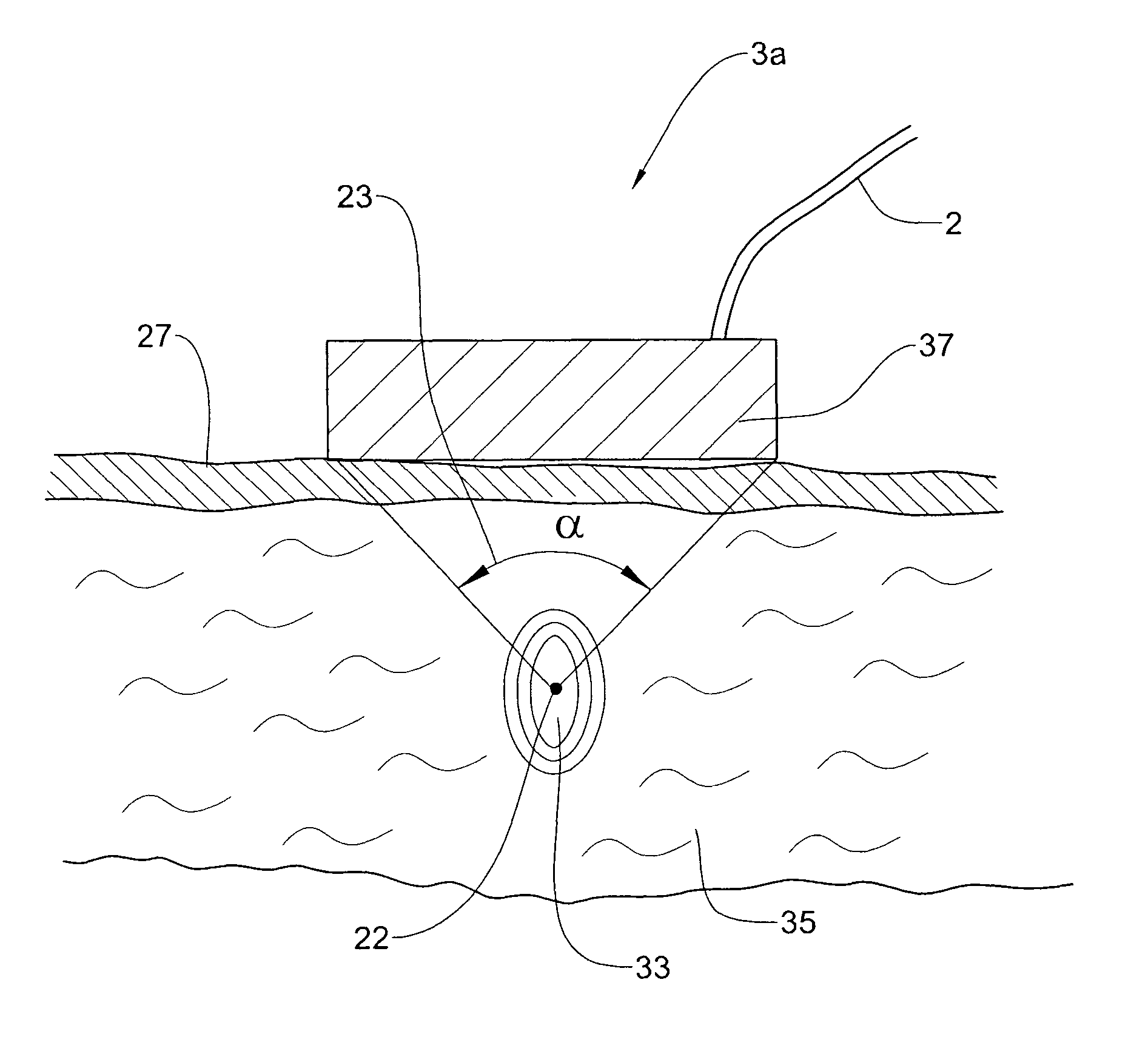 Method and apparatus for treatment of adipose tissue