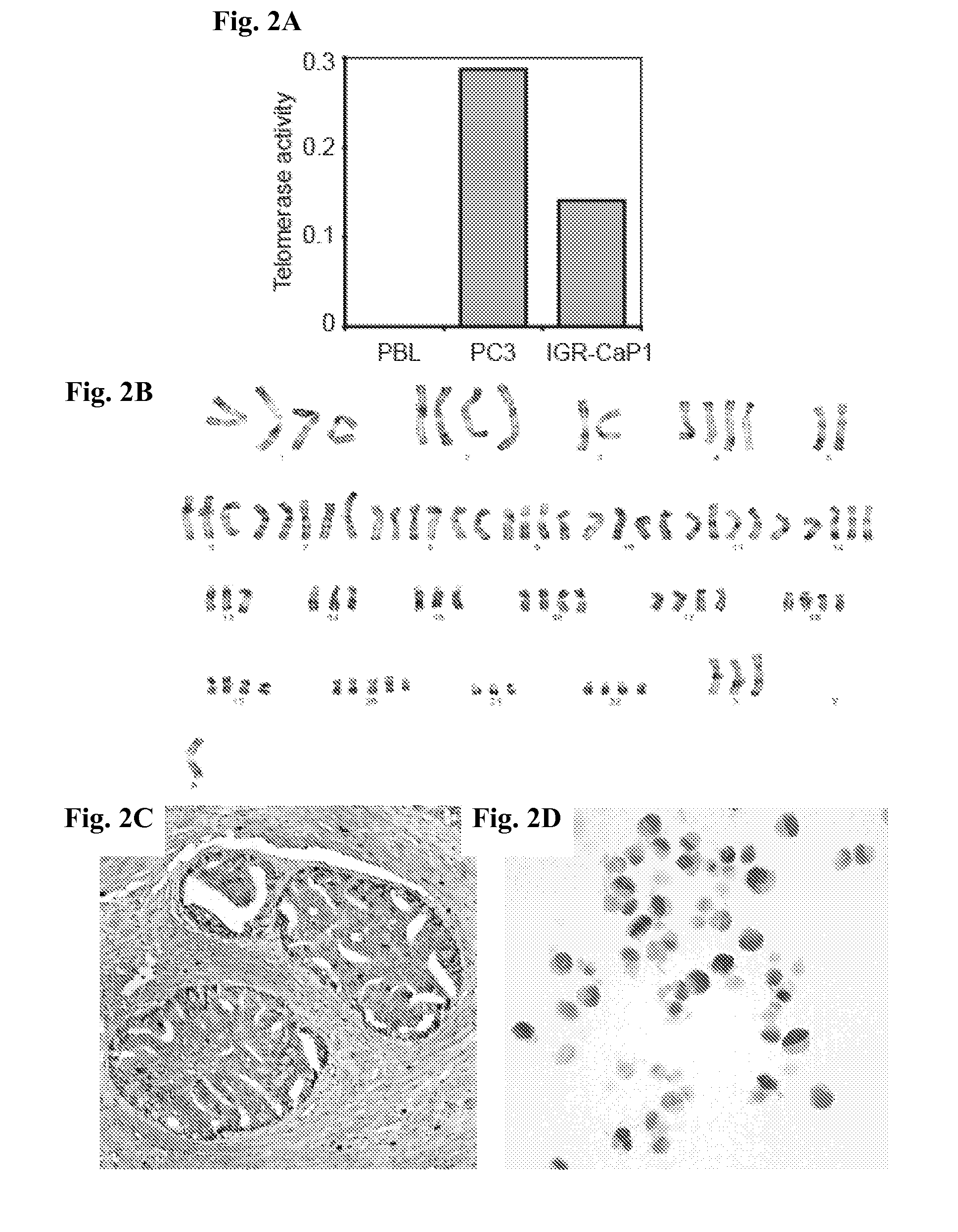 Prostate cancer cell lines and their use in screening method