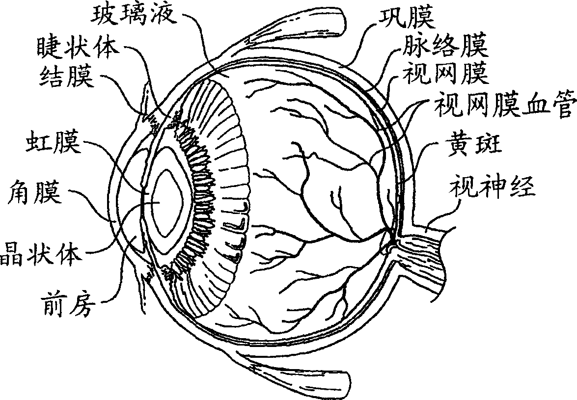 Compositions and methods of administering tubulin binding agents for the treatment of ocular diseases