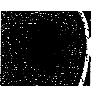 Compositions and methods of administering tubulin binding agents for the treatment of ocular diseases