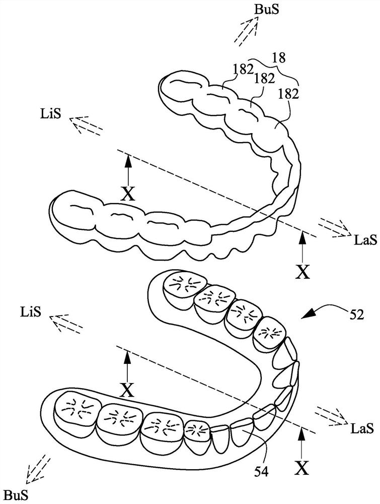 Dentition orthodontic brace and manufacturing method thereof