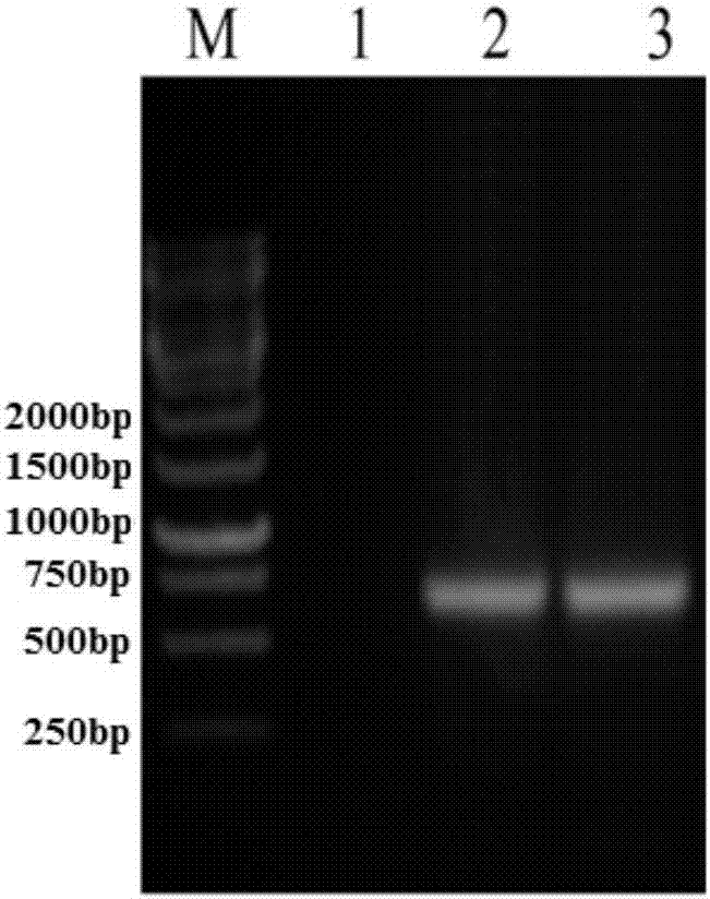 sH2a monoclonal antibody hybridoma and monoclonal antibody and application thereof