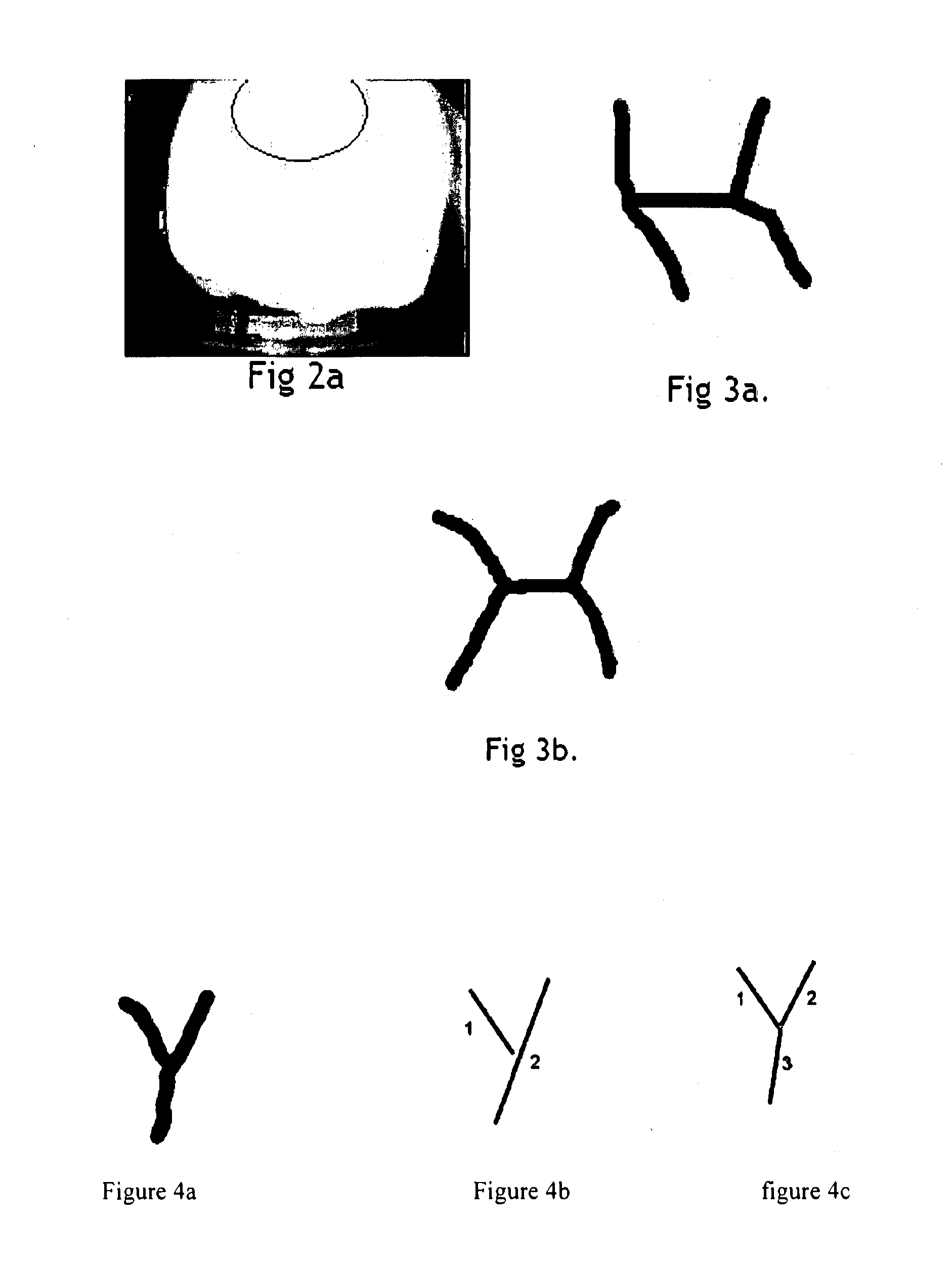 Vein pattern recognition based biometric system and methods thereof