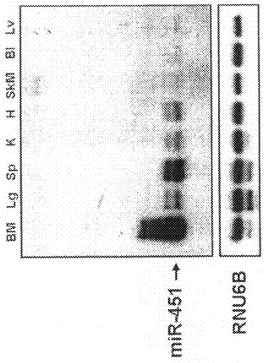 Antimir-451 for the treatment of polycythemias