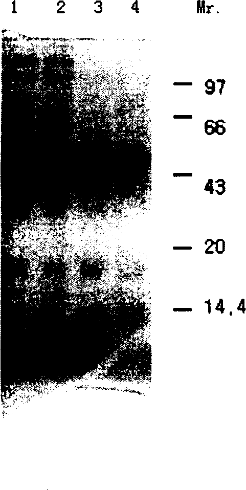 Method for synchronous detection of multiple tubercle bacillus specific secretion antigens