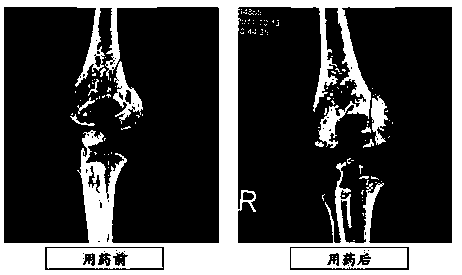 Composition for promoting fracture healing and preparation method of water decoction thereof