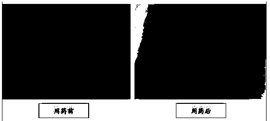 Composition for promoting fracture healing and preparation method of water decoction thereof