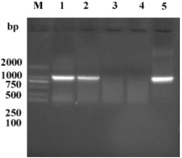 Recombinant bacillus calmette-guerin vaccine strain with over-expression mycobacterium tuberculosis Rv3586 and application of recombinant bacillus calmette-guerin vaccine strain