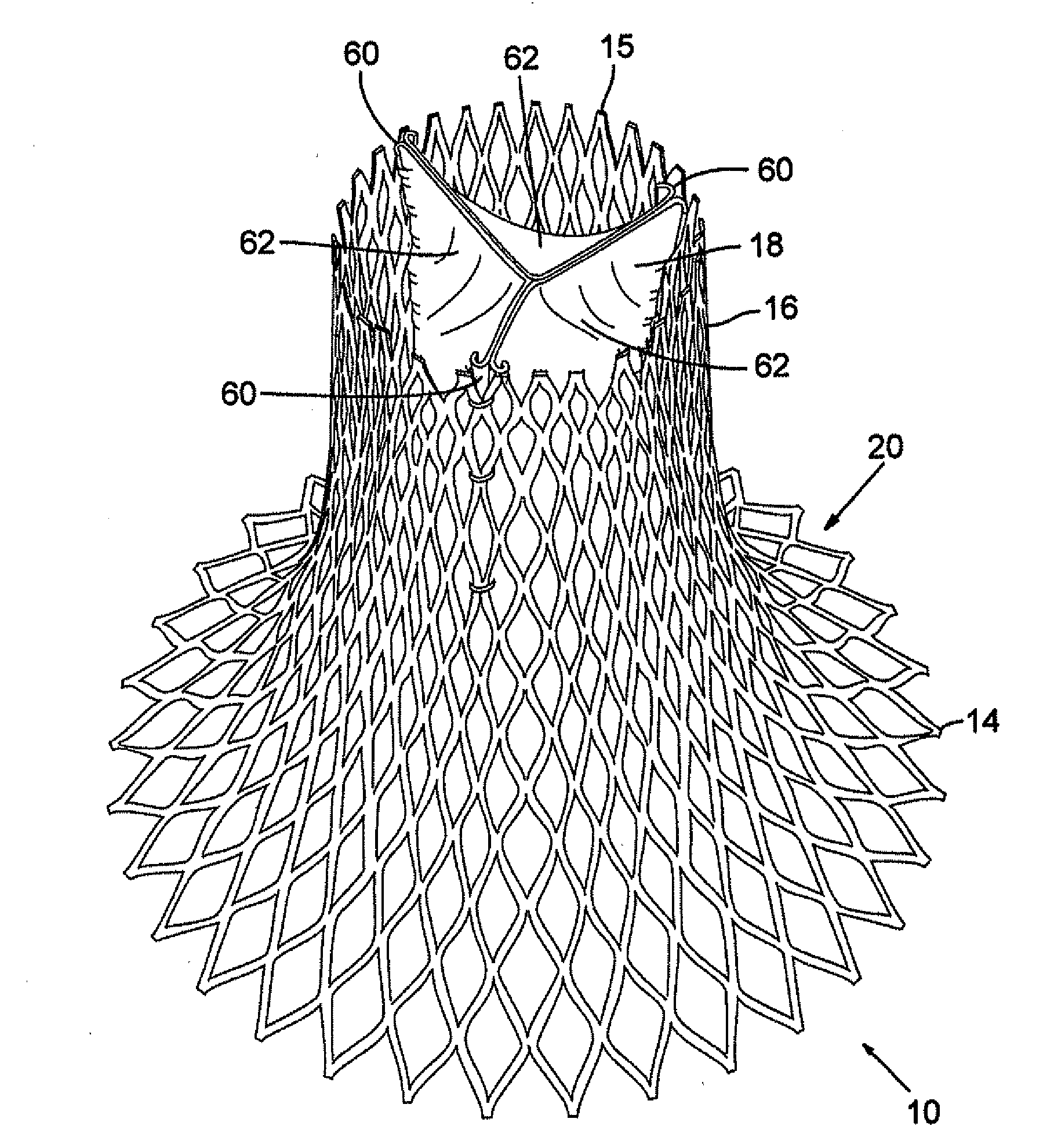 Device and method for replacing mitral valve