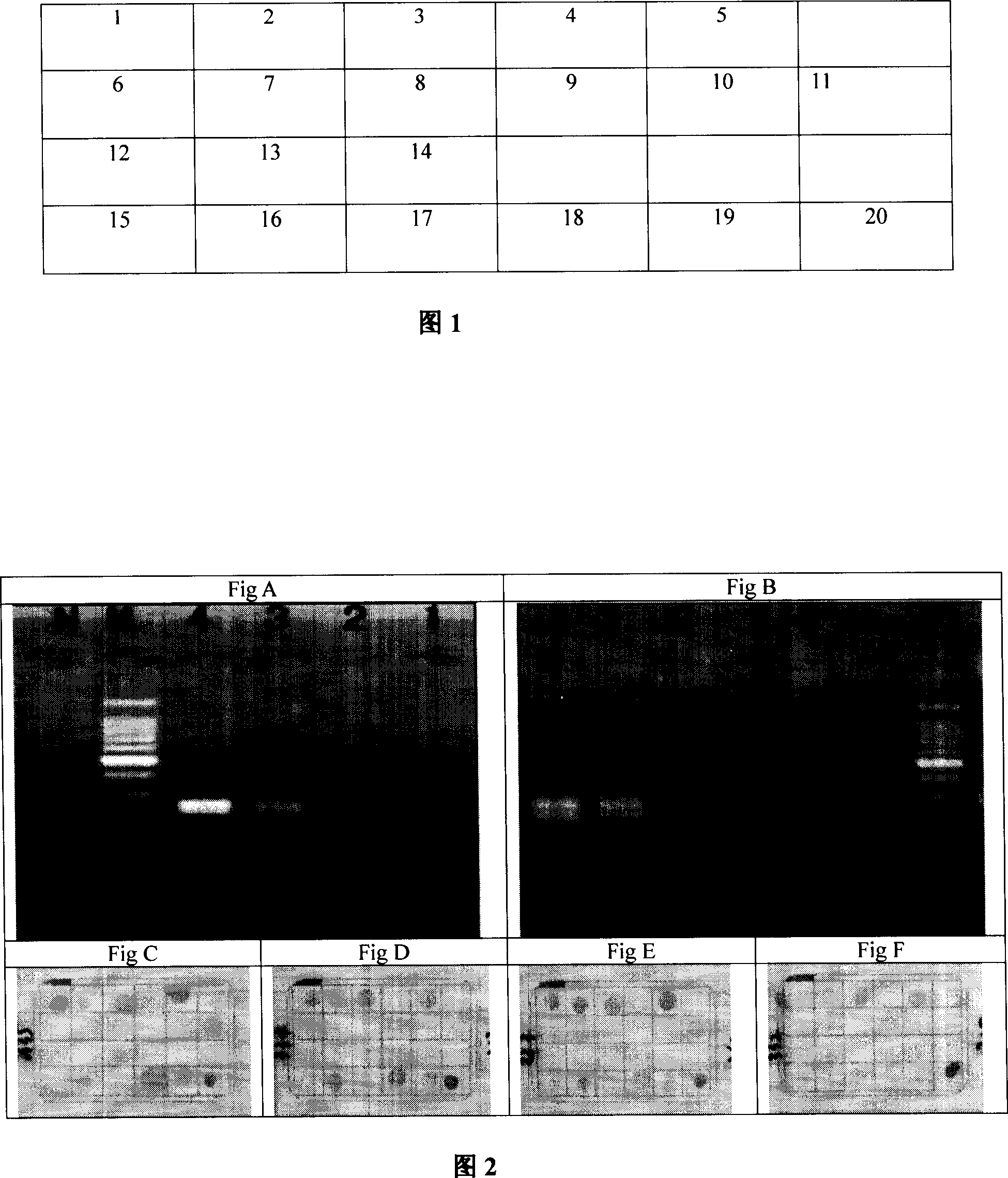 Method and kit for detecting mycobacterium tuberculosis and drug-resistant gene mutation thereof