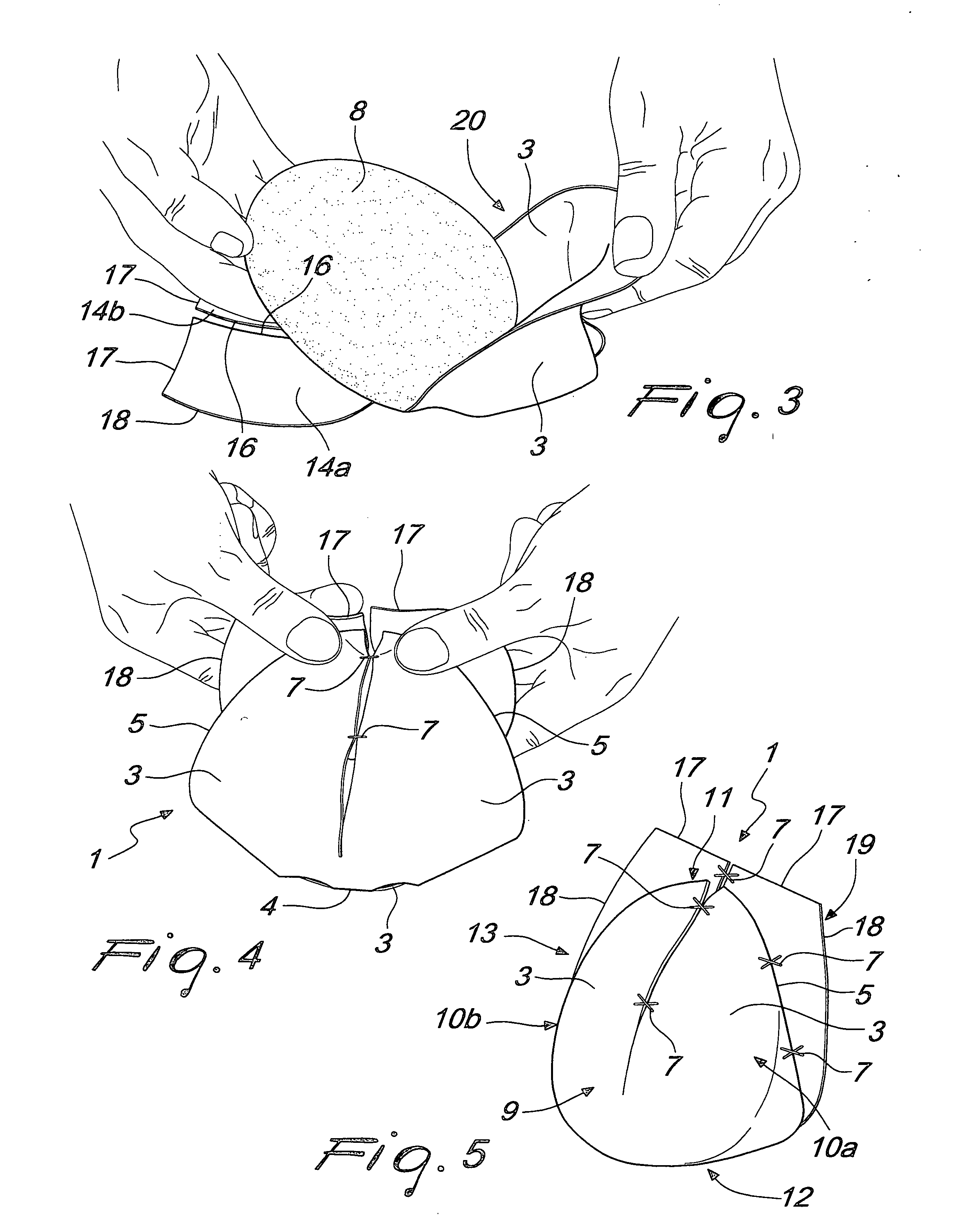 Medical device for breast reconstruction