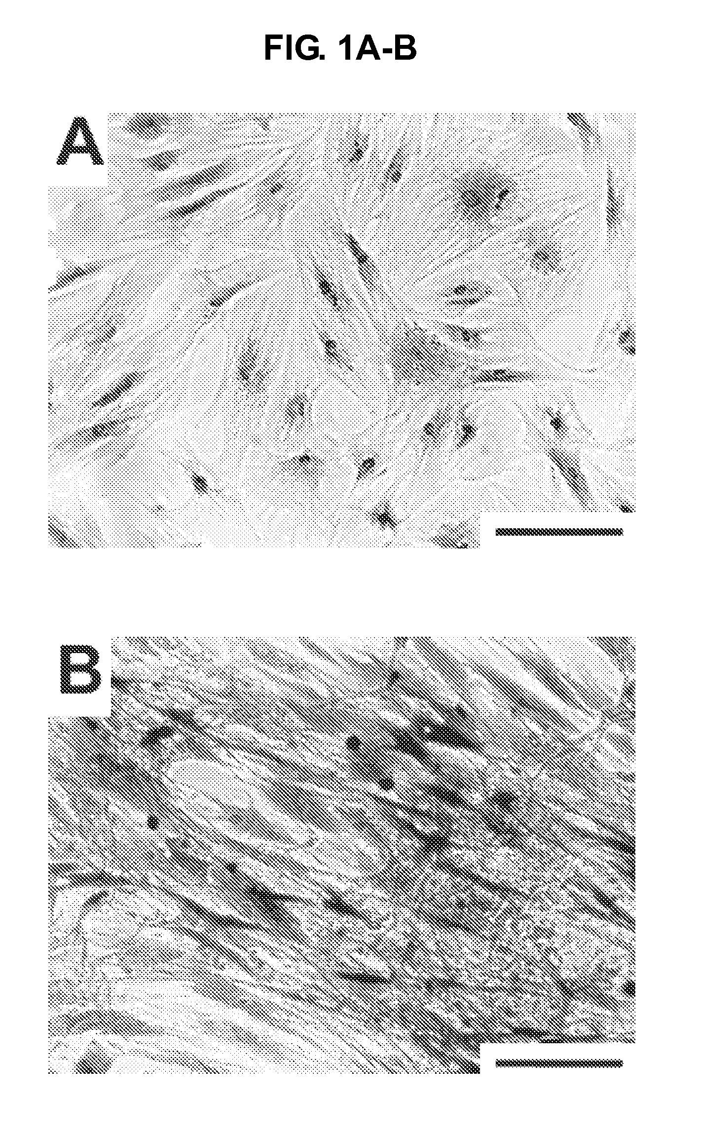 Compositions and methods for wound treatment