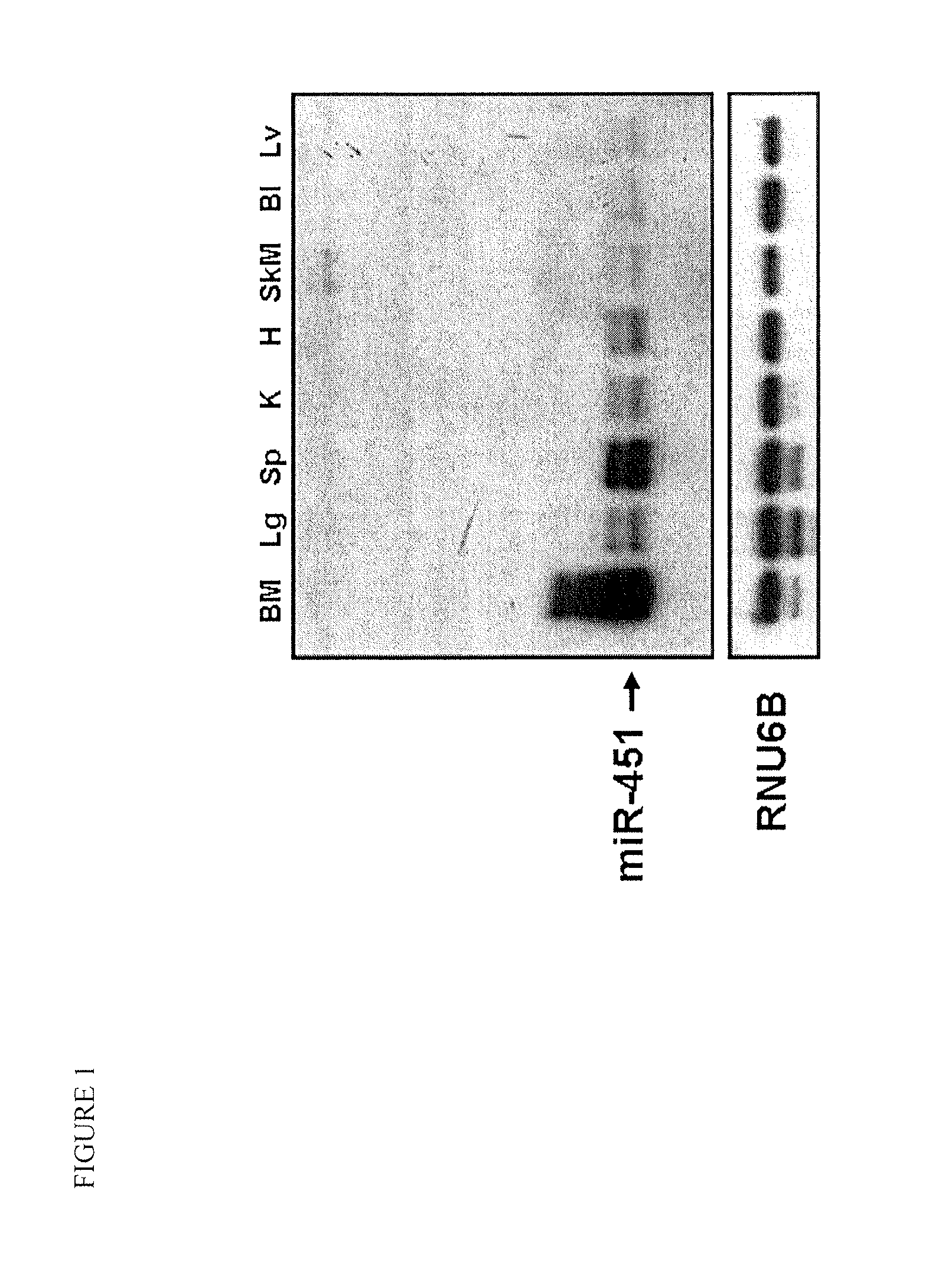 Antimir-451 for the treatment of polycythemias