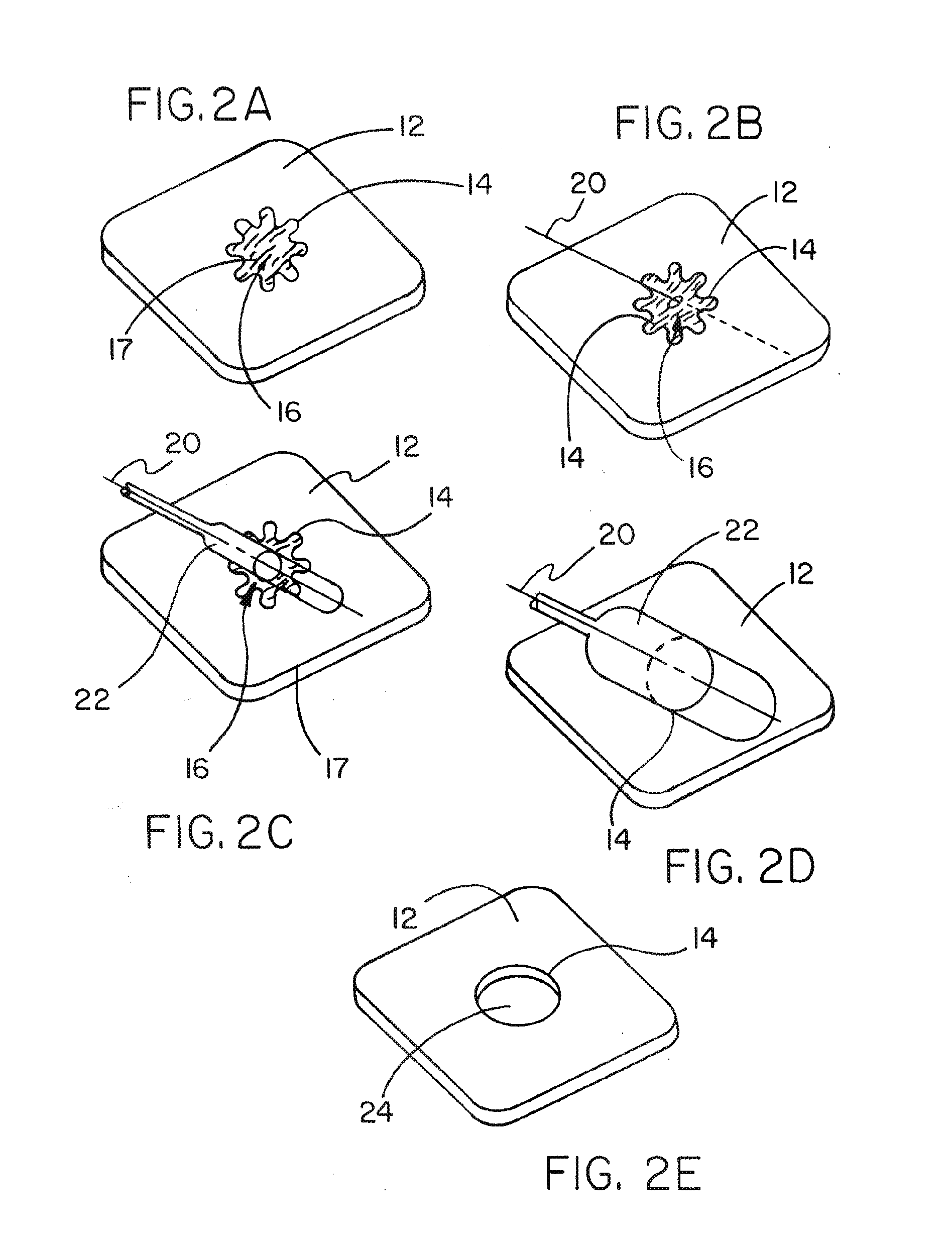 Medical device ameneable to fenestration