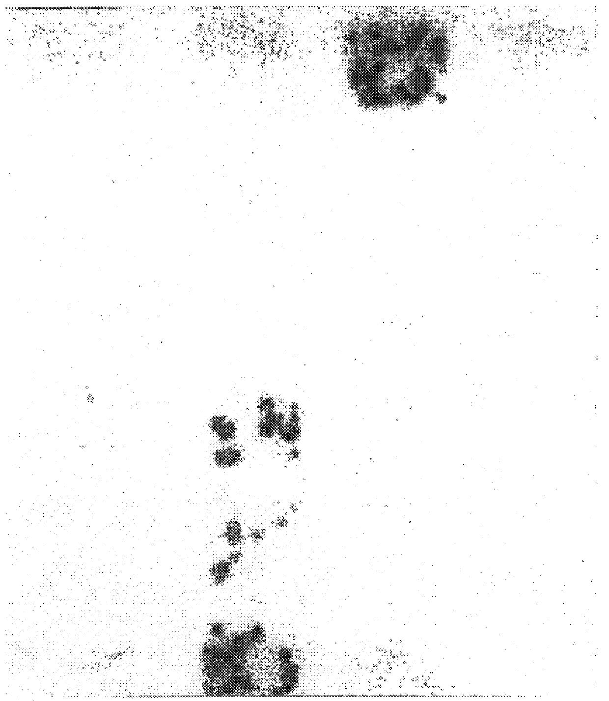 House dust mite allergen, Der p VII, and uses thereof