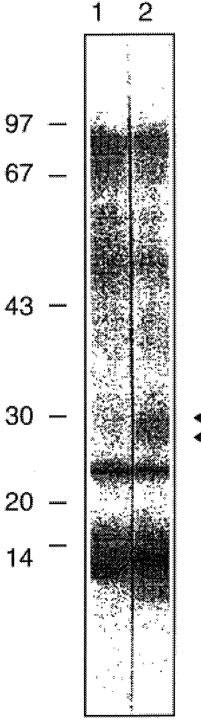 House dust mite allergen, Der p VII, and uses thereof
