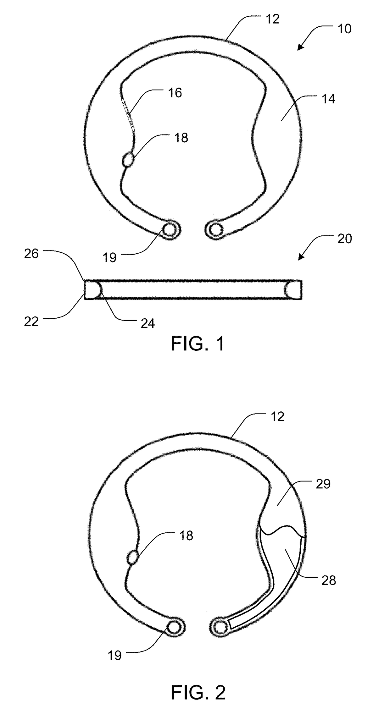 Intraocular drug delivery device and associated methods