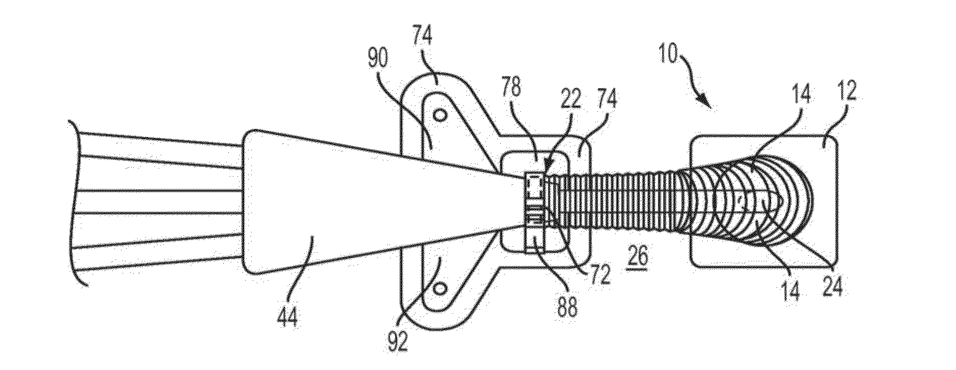 Catheter Extension With Integrated Circumferentially Sealing Securement Dressing