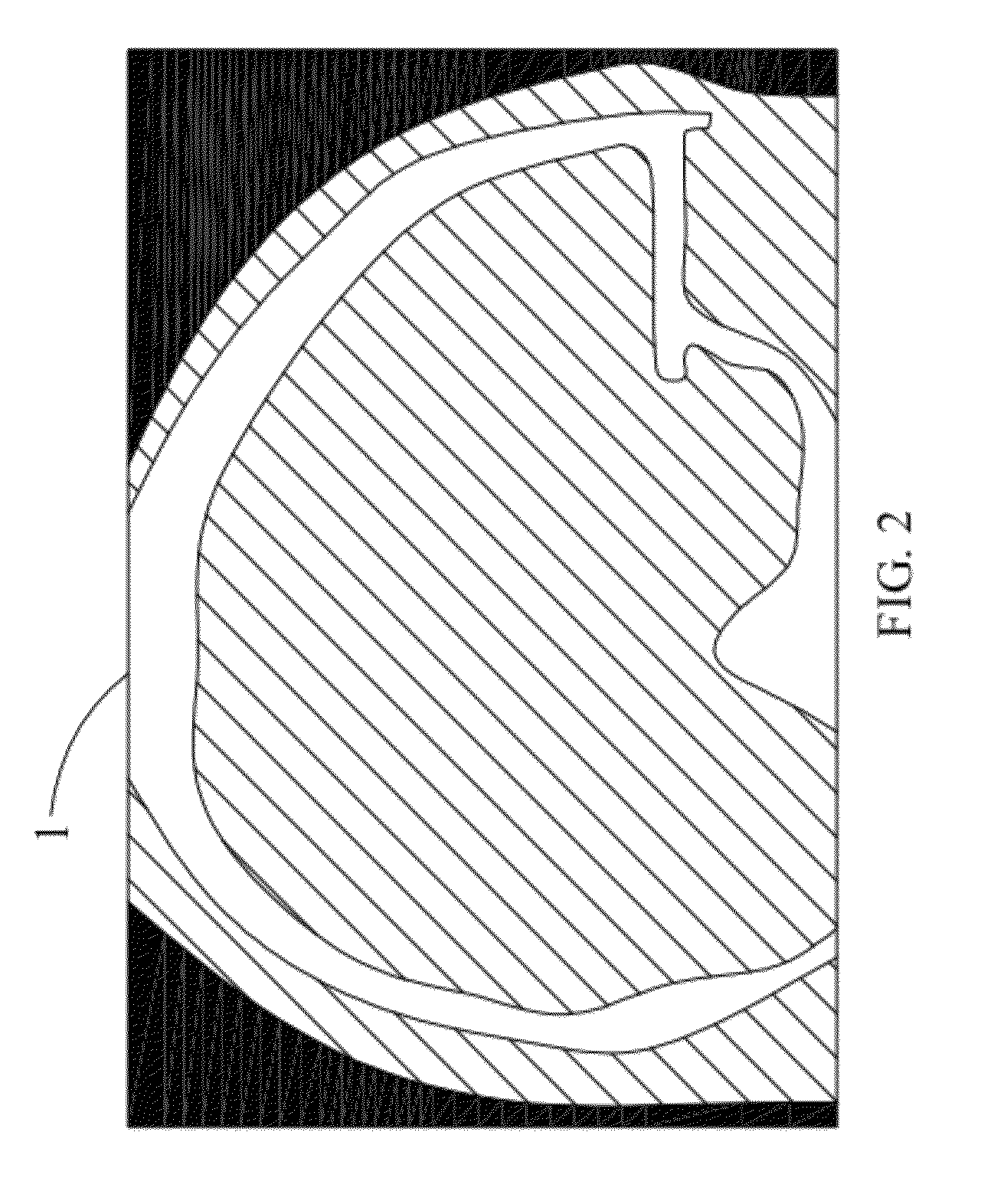 Method for manufacturing artificial implants