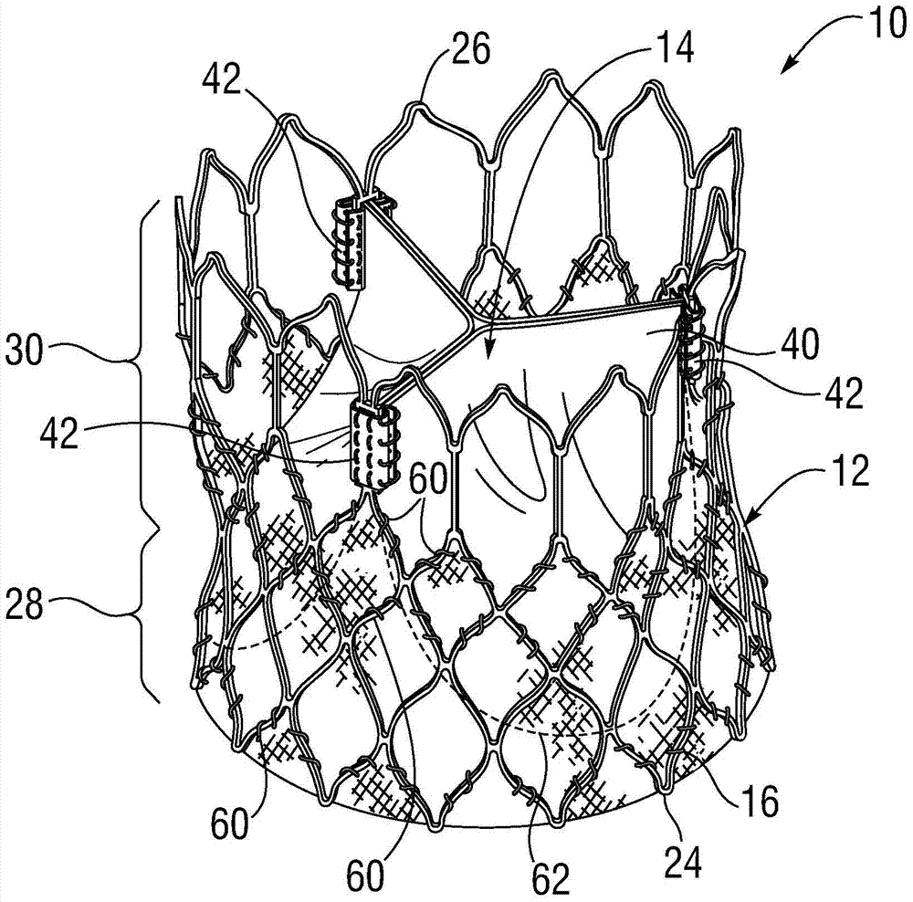 Prosthetic heart valve with improved commissural support