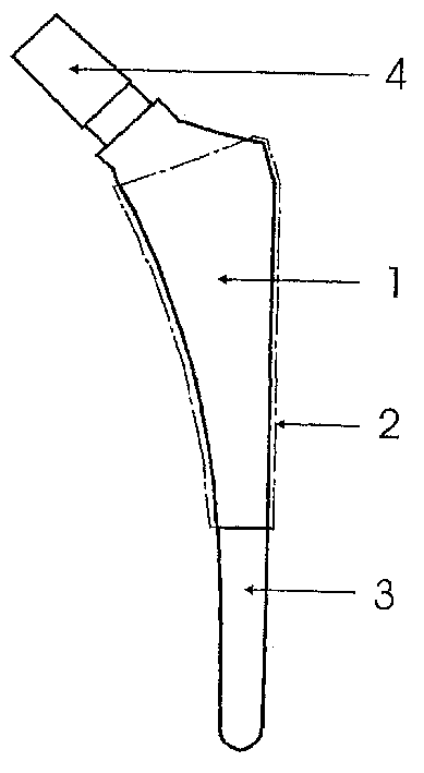 Body joint replacement titanium implant comprising one or several base bodies