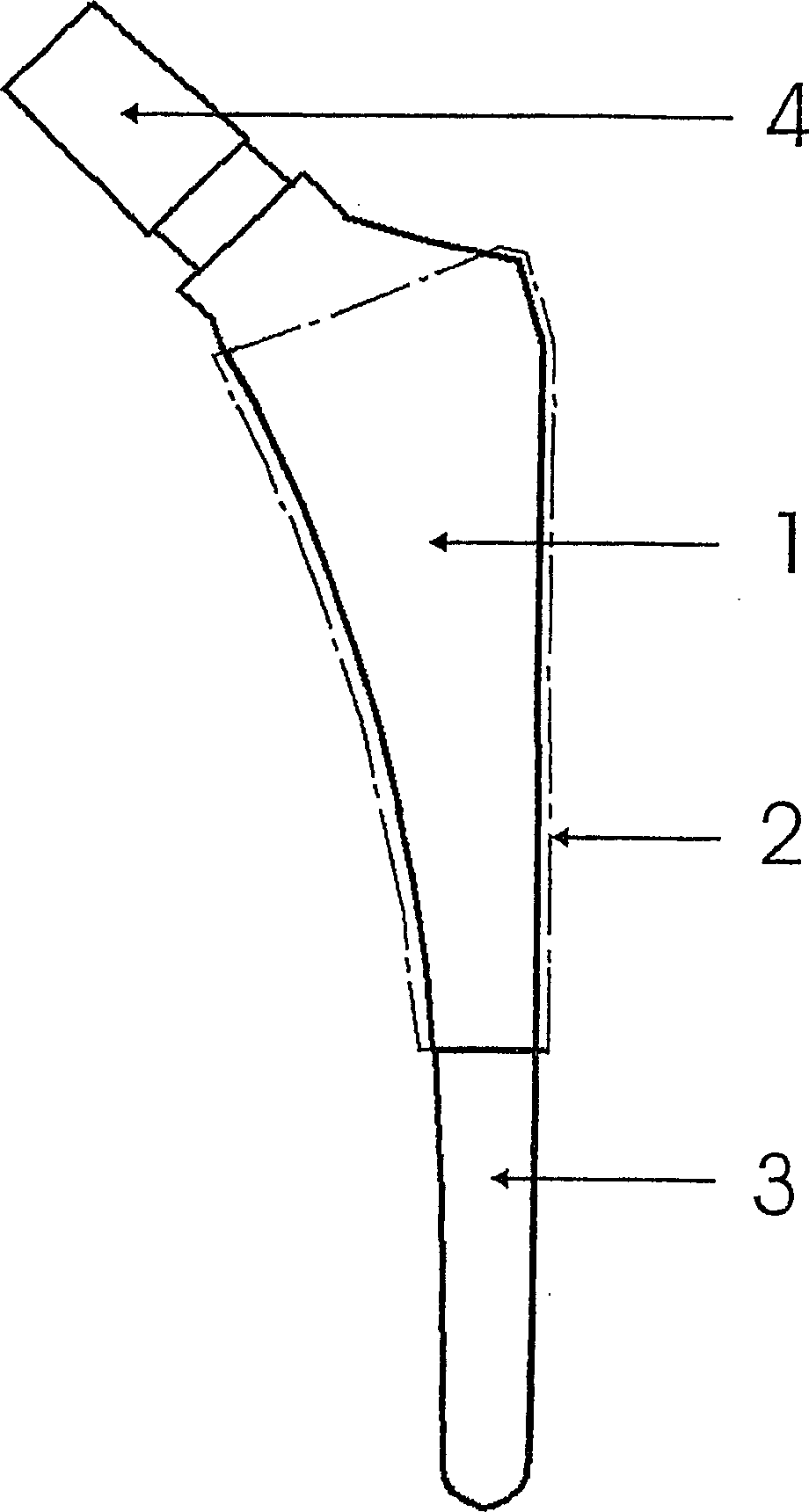 Body joint replacement titanium implant comprising one or several base bodies