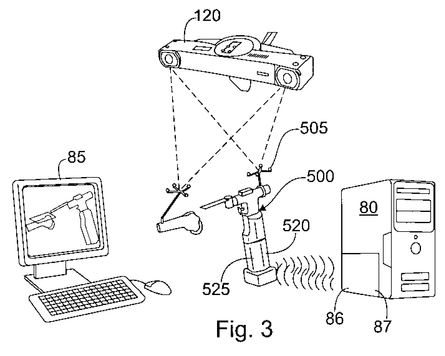 Method and Apparatus for Computer Aided Surgery