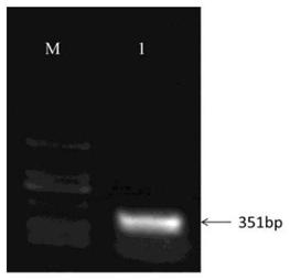 Gene for improving cyst nematode resistance of soybeans and application of gene