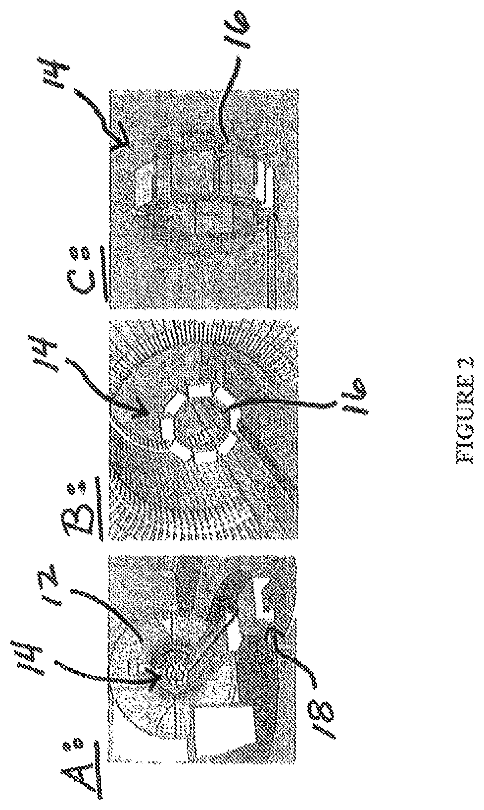 Apparatus and implementation method of a set of universal compact portable MR-compatible PET inserts to convert whole-body MRI scanners into organ-specific hybrid PET/MRI imagers