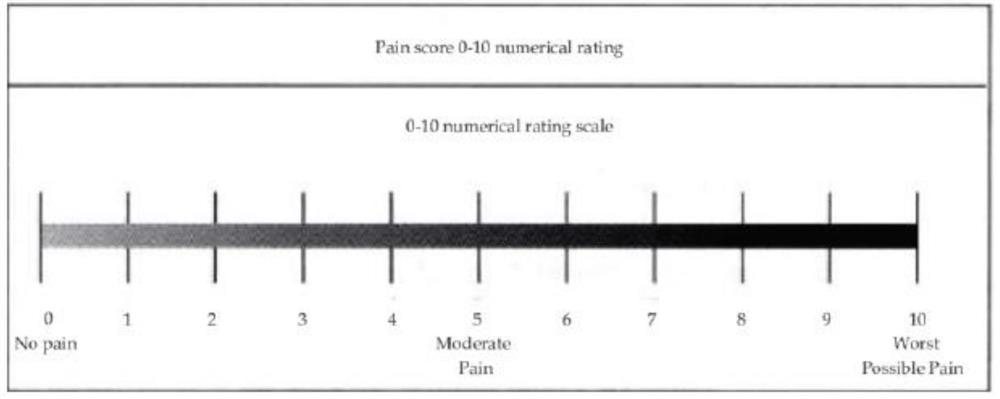 Parturition pain assessment system and method