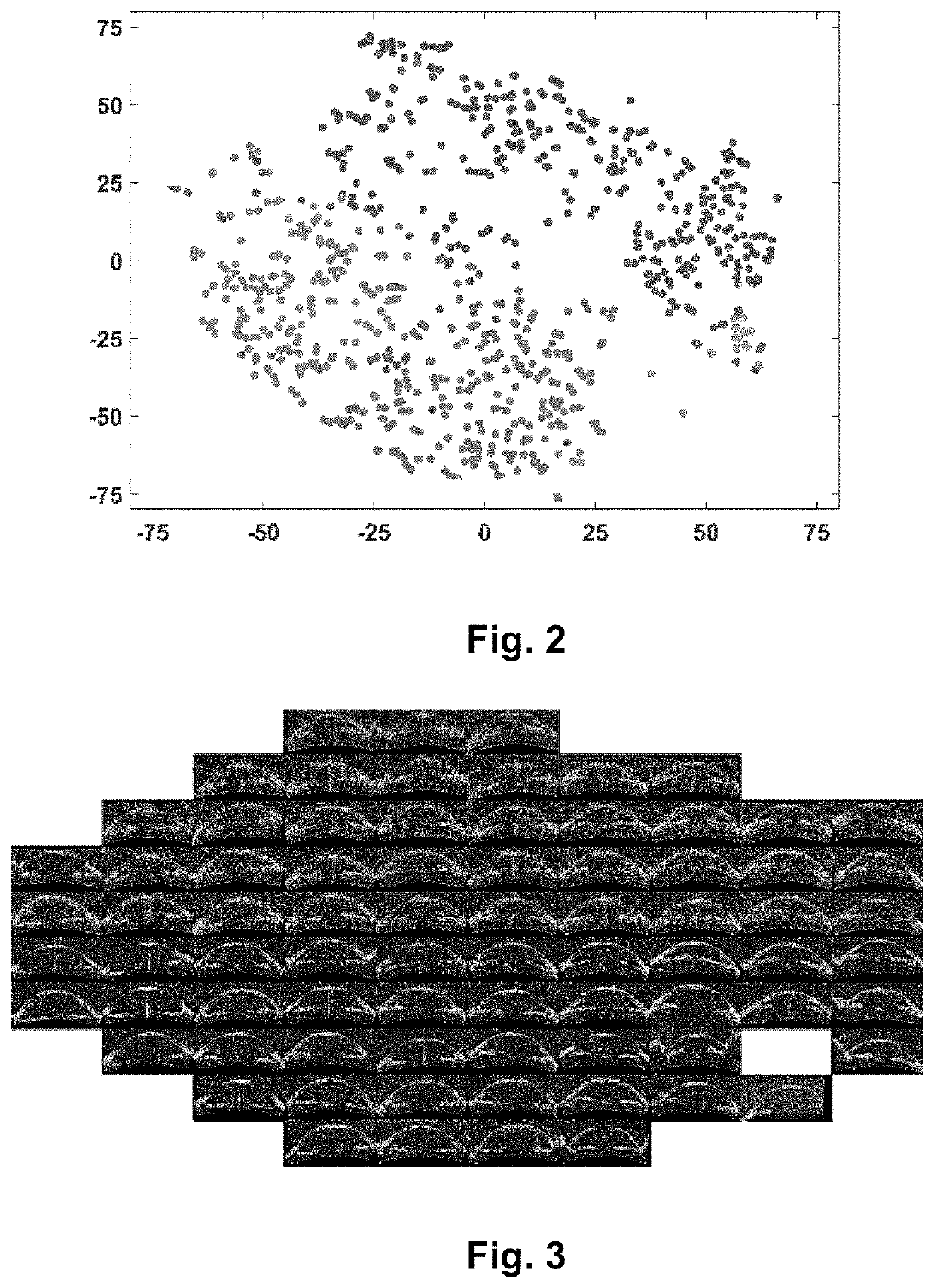 Image processing method for glaucoma detection and computer program products thereof