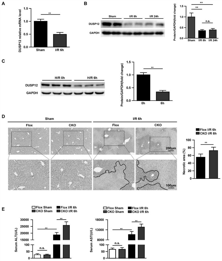 Application of DUSP12 in hepatic ischemia reperfusion injury (IRI)