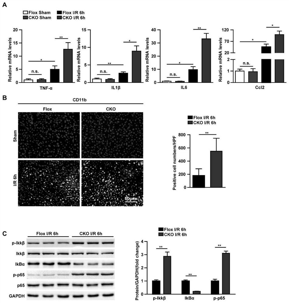 Application of DUSP12 in hepatic ischemia reperfusion injury (IRI)