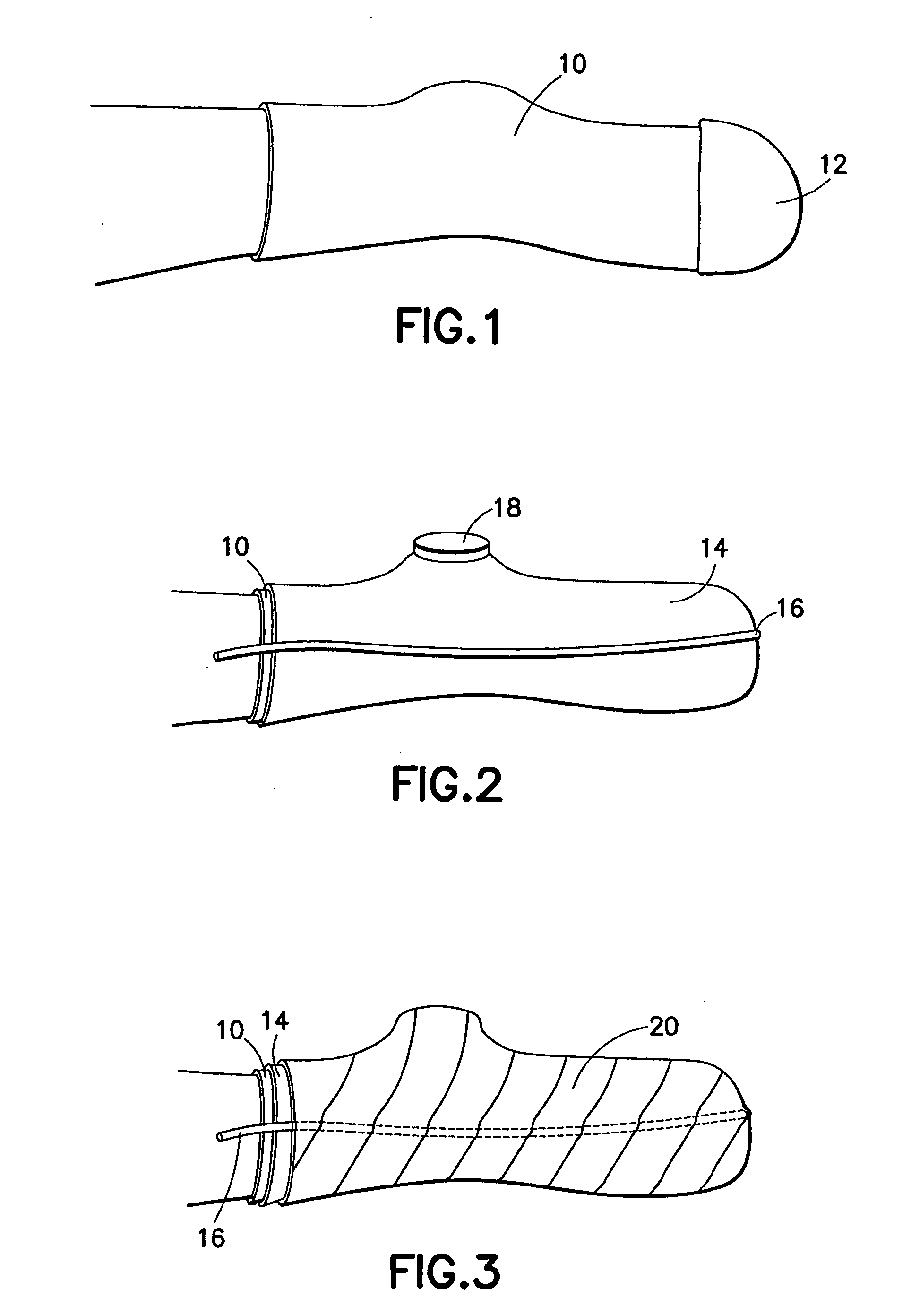 Post-operative dressing for below knee amputees