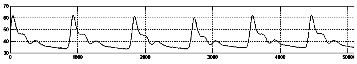 Peripheral vascular resistance detecting device and method based on ECG and pulse wave morphological parameters