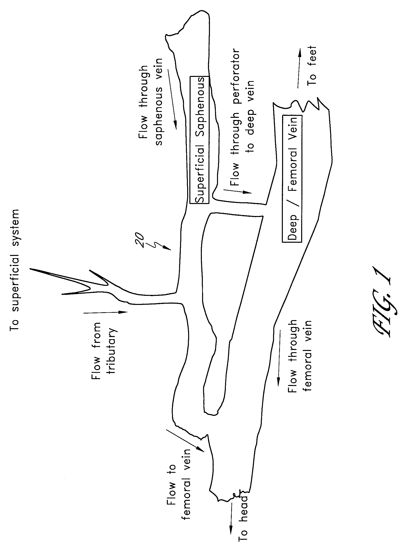 Method and apparatus for impeding migration of an implanted occlusive structure