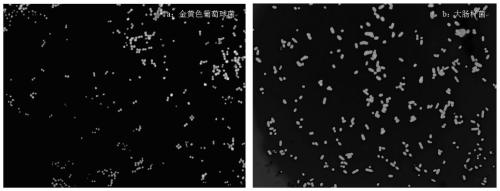 A material with antibacterial synergistic anti-bacterial adhesion function and its preparation and application