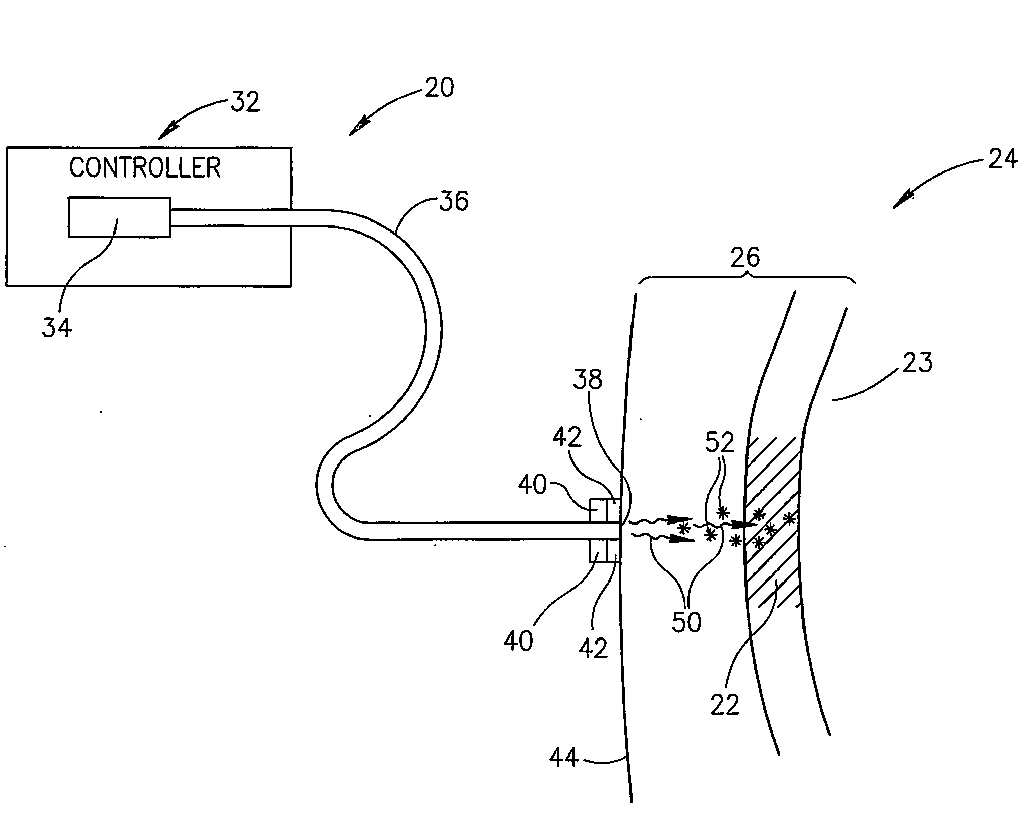 Photoacoustic Assay Method and Apparatus