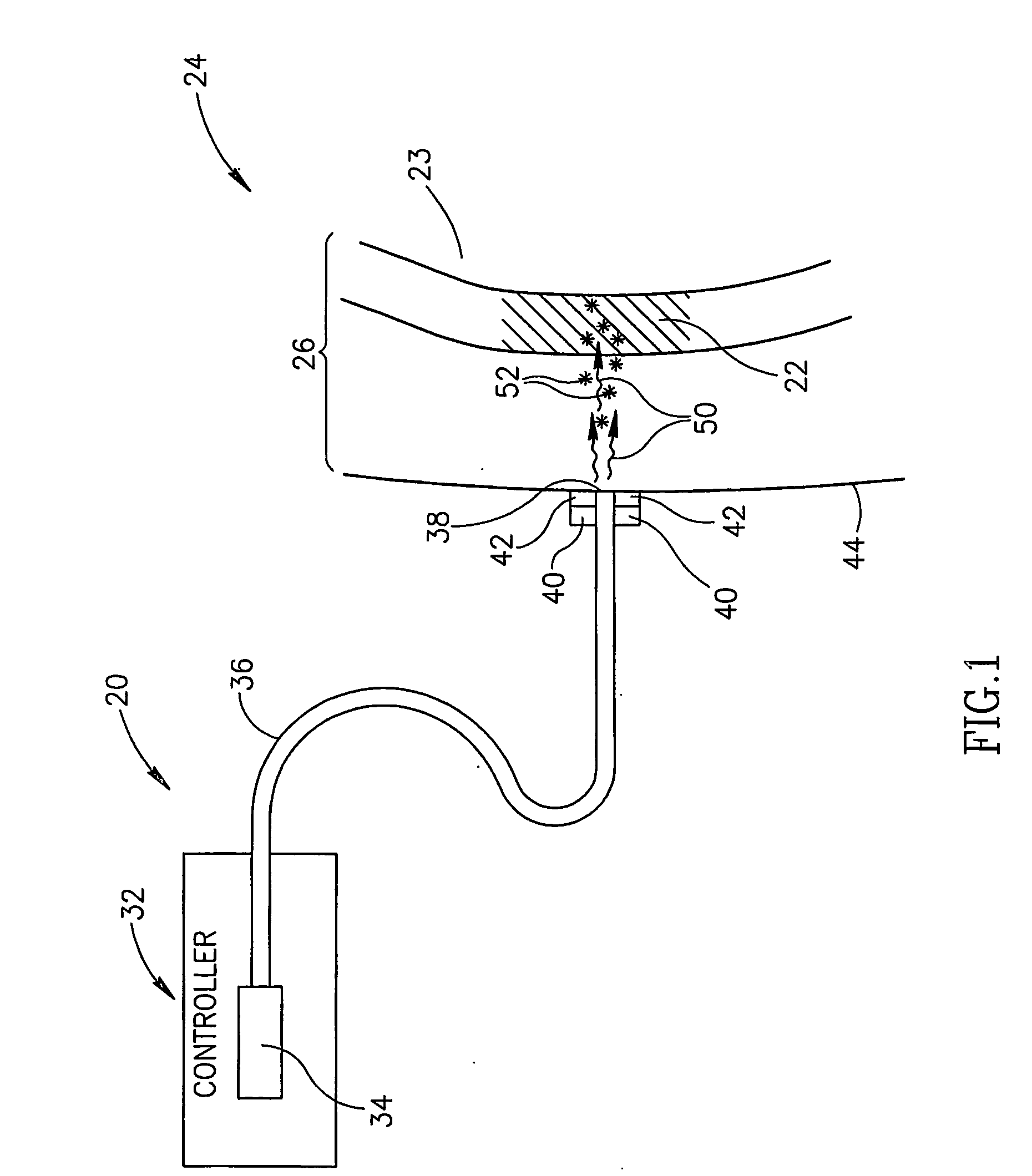 Photoacoustic Assay Method and Apparatus