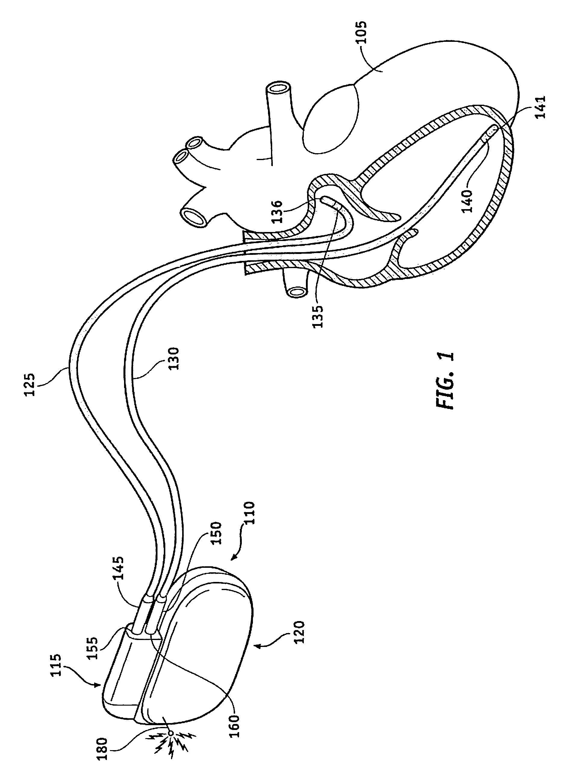 Radio frequency antenna flexible circuit interconnect with unique micro connectors