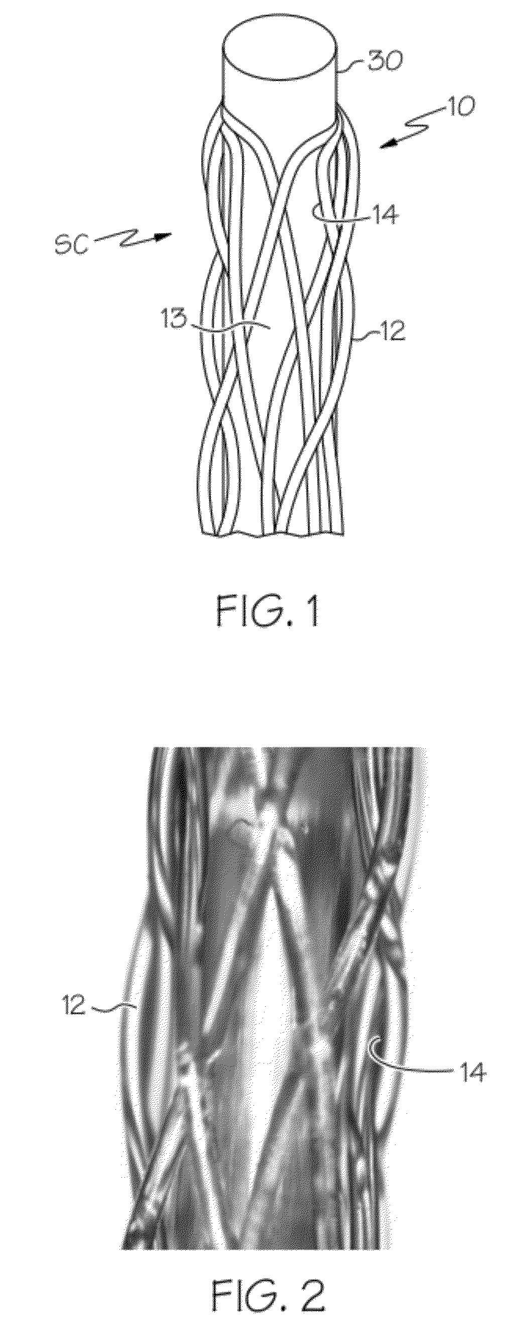 Monofilament-reinforced hollow fiber membrane