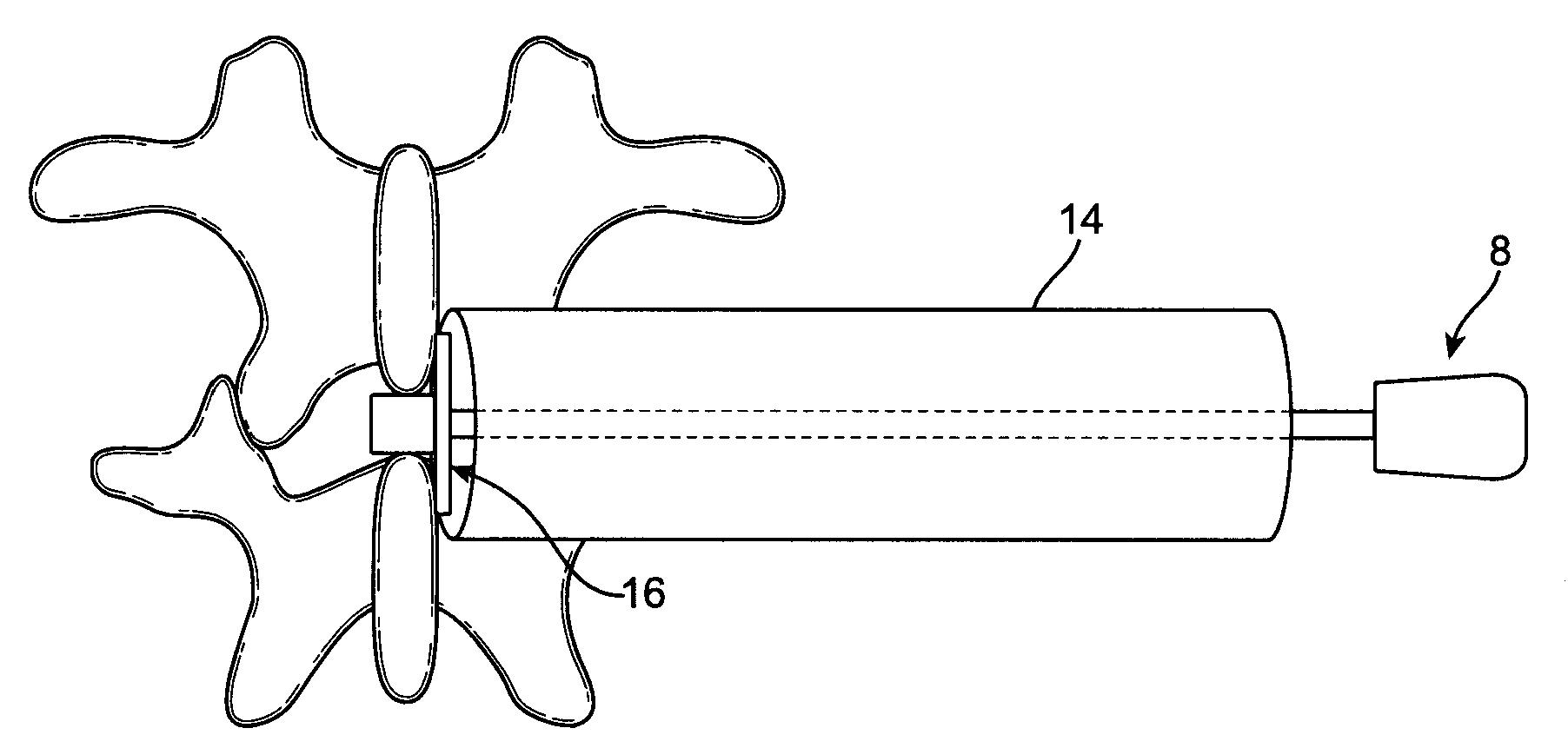 Implant device and method for interspinous distraction