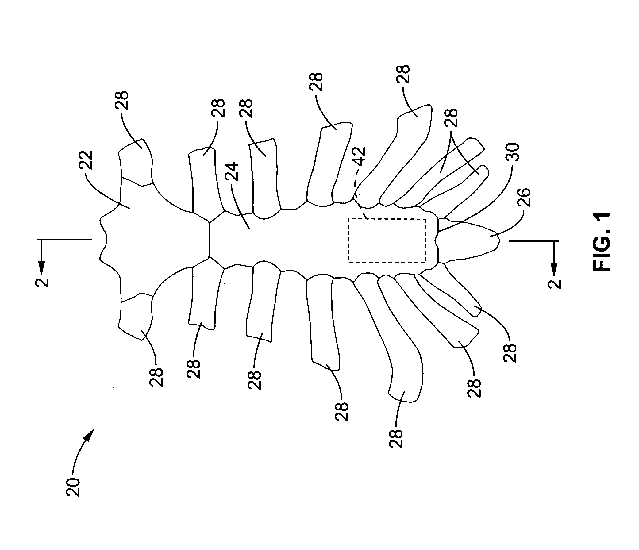 Apparatus and methods for magnetic alteration of deformities